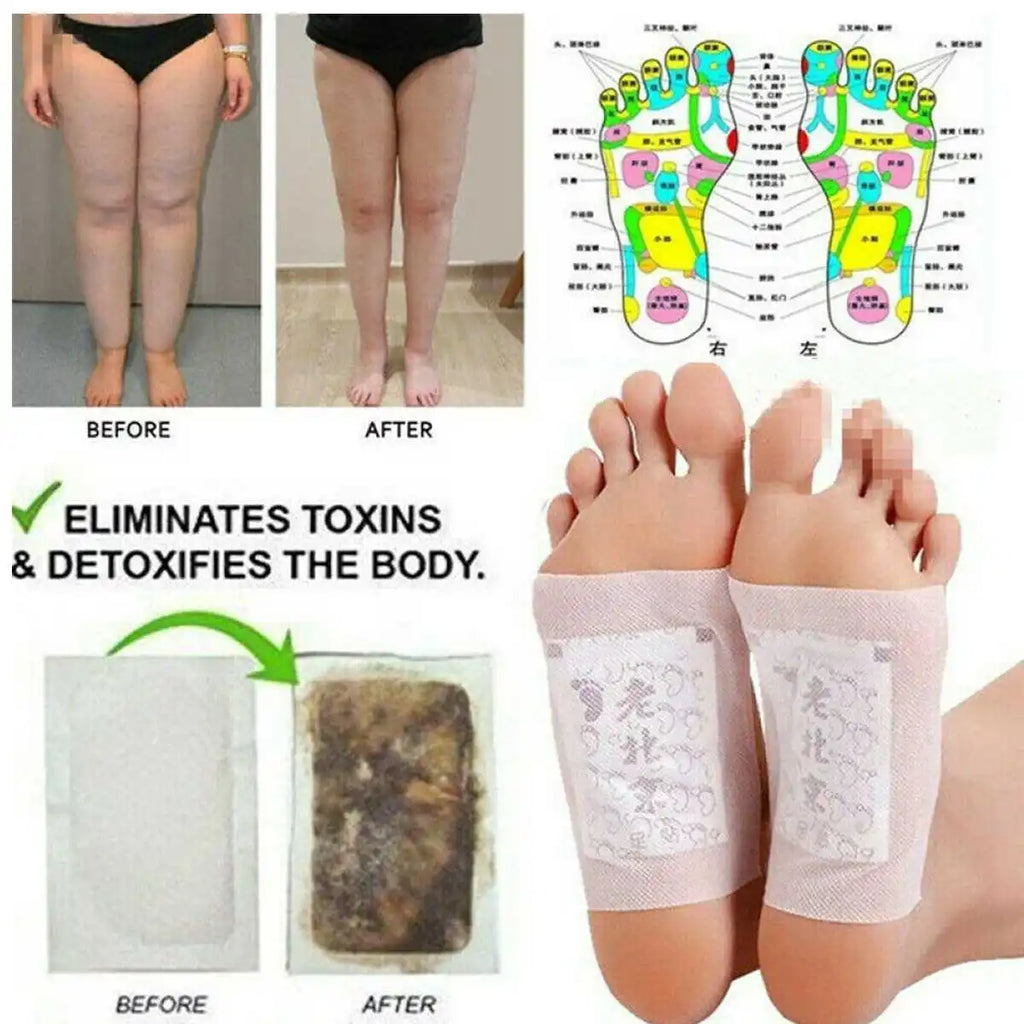Kinoki Detox Foot Patches - Nightly Cleansing Routine - ( 10PCS/BOX ) - BUY 1 BOX GET 1 FREE