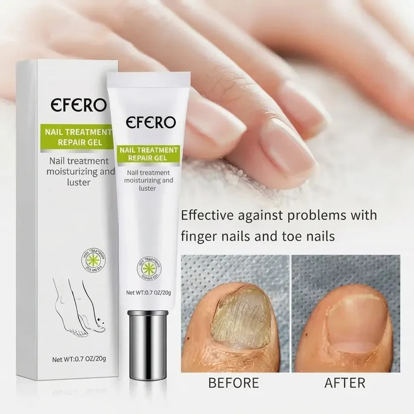 EFERO™ Advanced Anti-Fungal Nail Repair Gel