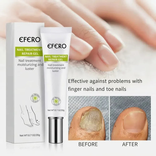 EFERO™ Advanced Anti-Fungal Nail Repair Gel
